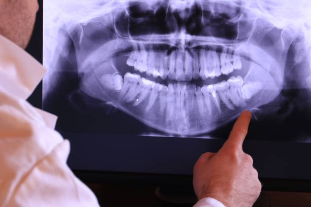 Best Emergency Treatment for Toothache in Wylie, TX