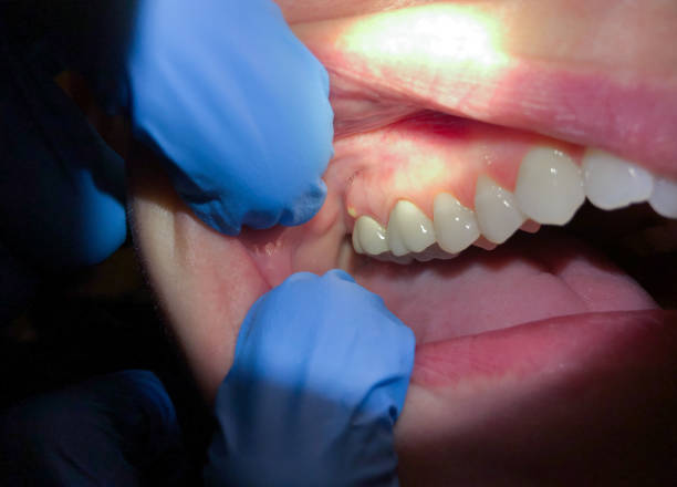 Best After-Hours Emergency Dentist in Wylie, TX
