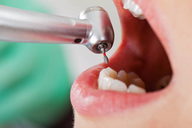 Best Emergency Dental Care for Trauma or Injury in Wylie, TX